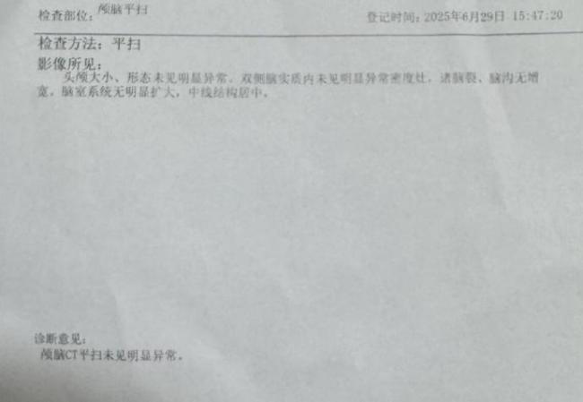 戴手表竟然被雷劈了！