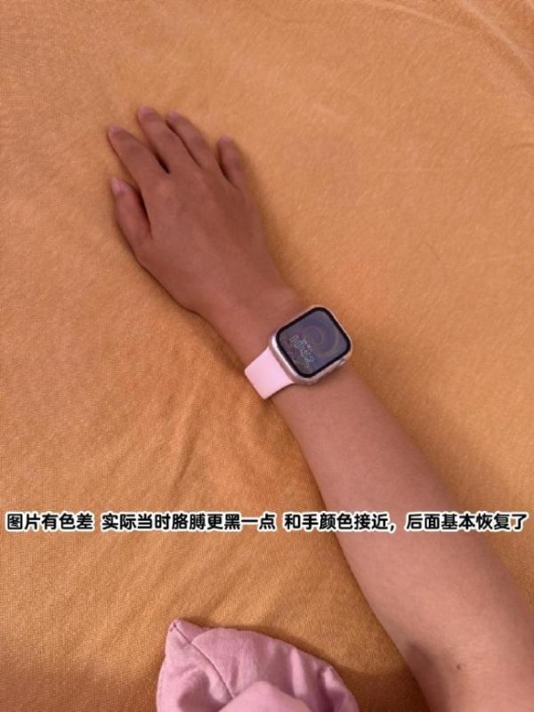 现货配资网站 戴手表竟然被雷劈了！