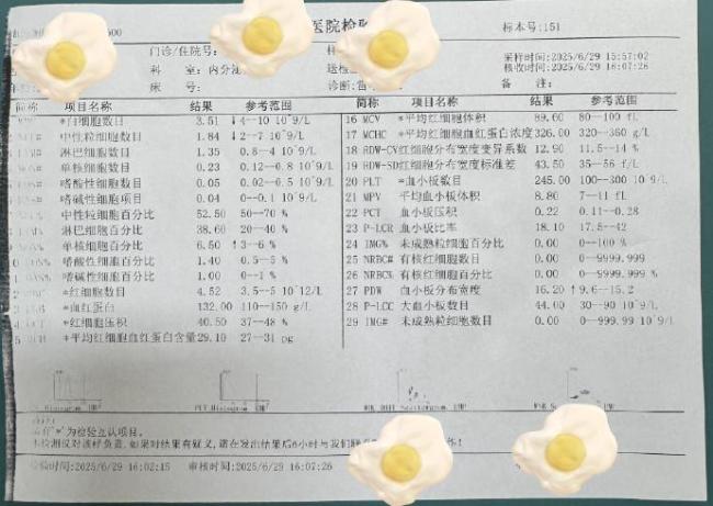 戴手表竟然被雷劈了！