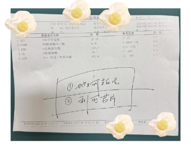 戴手表竟然被雷劈了！